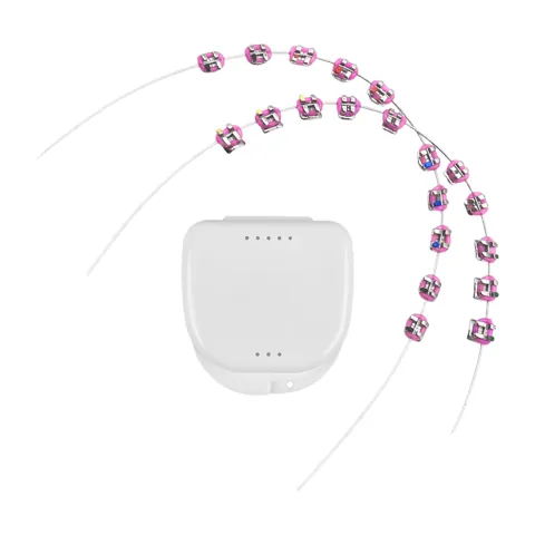 Temporary Tooth Brace Chain Pink